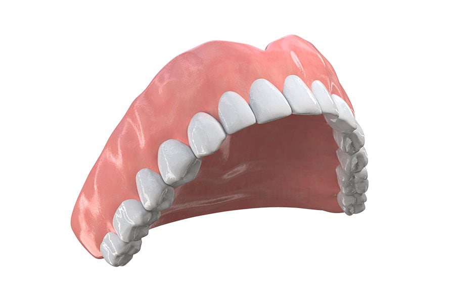 Traditional dentures verse dental implants in Chicago, IL. Traditional Dentures in Chicago, IL