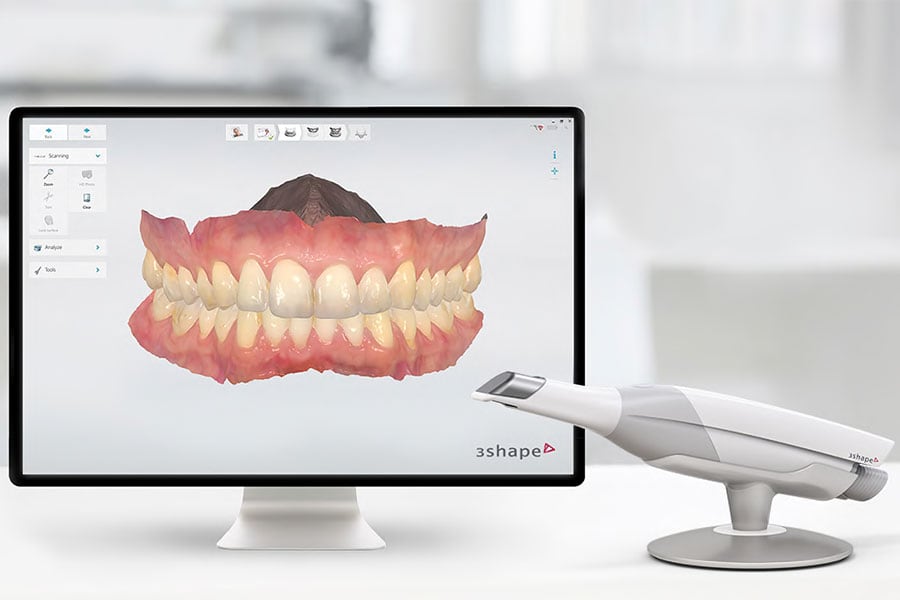 State-of-the-art digital impression system eliminates need for messy putty with 3D Model in Chicago, IL TRIOS 3Shape in Chicago, IL